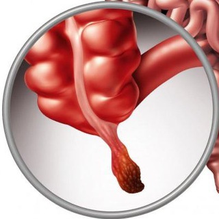 А вдруг аппендицит?